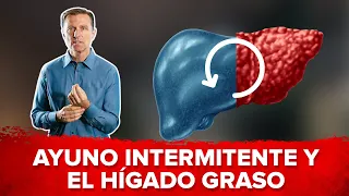 ¿Puede el ayuno revertir un hígado graso? -Subtitulado