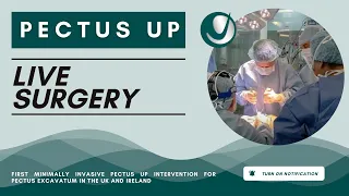 First Minimally Invasive Pectus UP Intervention for Pectus Excavatum in the UK and Ireland