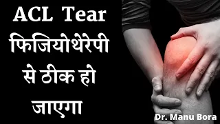 ACL Tear फिजियोथेरेपी से ठीक हो जाएगा, ACL Tear Recover With Physiotherapy Dr. Manu Bora