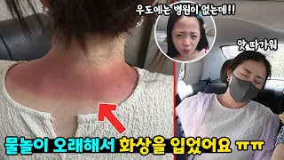 물놀이 6시간했는데 화상을 입었어요!! 우도에는 병원도 없는데 어떡하죠??? 가족일상 제주도 여행 브이로그 / 뚜아뚜지TV