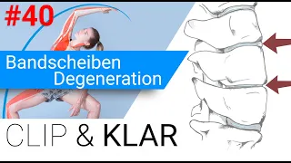 Bandscheiben Degeneration erklärt - Na und?