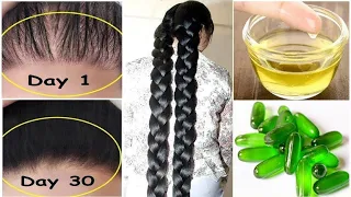 इस तरह लगाए Vitamin E Capsule बालो को तेजी से बढ़ाने के लिए- Vitamin E For Hair Growth Tips