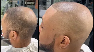 💈How to fade a client with thinning hair #NoEnhancements