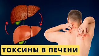 10 признаков того что в вашей ПЕЧЕНИ полно Токсинов и Шлаков #циррозпечени