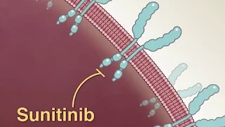 Treating Advanced Renal-Cell Carcinoma