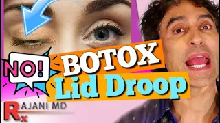 BOTOX EYELID DROOP- Botox Before and After