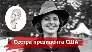 Как Лоботомия разрушила жизнь Розмари Кеннеди, сестре Президента США Джона Кеннеди