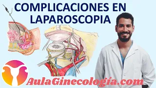 COMPLICACIONES EN LAPAROSCOPIA: cómo evitarlas, reconocerlas y tratarlas.- Ginecología y Obstetricia