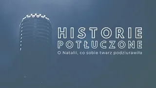 Historie potłuczone [#58] O Natalii, co sobie twarz podziurawiła