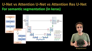 226 - U-Net vs Attention U-Net vs Attention Residual U-Net - should you care?