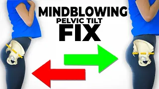 The Mindblowing Best Fix For Anterior Pelvic Tilt (instant results)