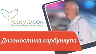 Диагностика карбункула. Фурункул, гидраденит, флегмона, абсцесс или карбункул