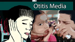 Otitis Media- Acute otitis media,  Otitis media with effusion  Symptoms and treatment