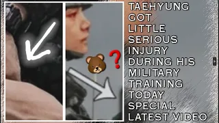 OMG😭💋Taehyung Got Little Serious Injury During His Military Training(Latest)#taehyung#jungkook#bts