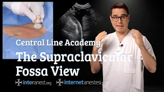 Central Line Academy: The Supraclavicular Fossa View
