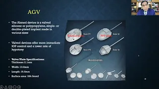 Lecture: Glaucoma Drainage Device Implants Made Easy