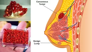 Top 12 Super Foods That Fight Breast Cancer