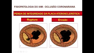 Dor Torácica   Aula 1/2 - Profª Meliza Goi Roscani