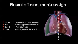 Chest III B  Prof. Dr. Mamdouh Mahfouz