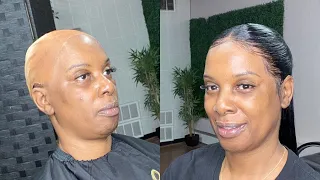 Alopecia Approved Hairstyle ✅ | Natural 360 ponytail |