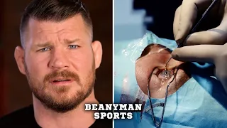 The kick that left Michael Bisping without an eye | Excerpts from Bisping: The Michael Bisping Story