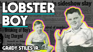Lobster Boy: Grady Stiles Jr.