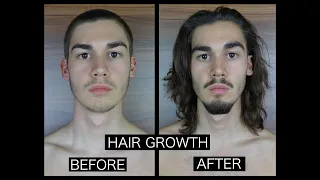 HAIR GROWTH TIME LAPSE - FRONT