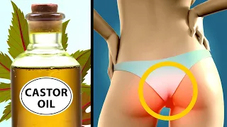 13 Surprising Uses of Castor Oil