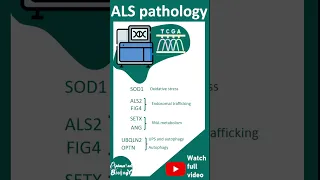 ALS | Amyotrophic lateral sclerosis | pathology and diagnosis | USMLE | 1 minute pathology