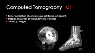 Imaging of Bone tumors I  DRE 10   Dr Mamdouh Mahfouz