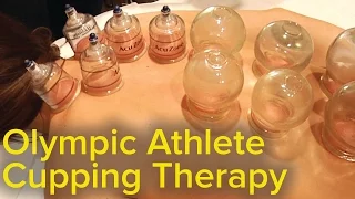 Chinese Cupping Therapy - Michael Phelps Olympics Bruise Mystery Solved | Pain Relief and Therapy