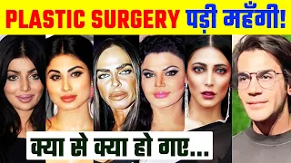 Plastic Surgery से पहले और बाद की 10 Bollywood Actress / Before and After Actresses