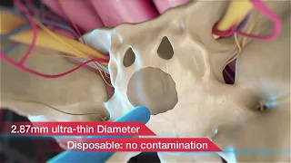 Complete Pituitary Tumor Visualization