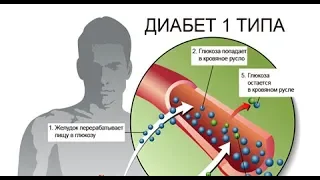 Сахарный ДИАБЕТ 1-го типа - это АУТОИММУННОЕ заболевание / Фролов Ю.А.