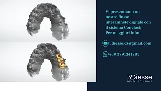 Flusso Di Lavoro Digitale - Protesi Conometrica 3Diesse