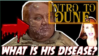 What was Wrong with the Baron? (DUNE LORE)