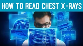 How to Read and Interpret a Chest X-ray Made Easy: Quick & EZ [Episode 20]