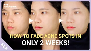 3 Secrets to Remove Acne Pigmentation & Brighten Skin Complexion in the Most Effective & Fast Way!
