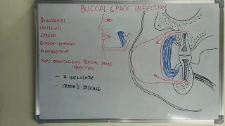 Buccal space infection