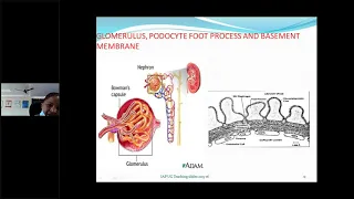 A Class on "Nephrotic Syndrome" by Dr A Vasundara,Professor&Hod,Peadiatrics,ASRAM,ELURU