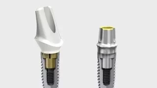 Nobel Biocare Implant Systems