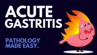 Acute Gastritis l Pathology Made Easy