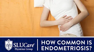 How Common is Endometriosis? What is it? - SLUCare OB/GYN