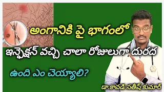 How to Cure Pubic Lice(Crabs) Infection in privite part|| Telugu || Doctor Satheesh || Yes1TV Health