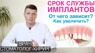 Срок службы зубных имплантов. От чего зависит срок службы имплантов для зубов