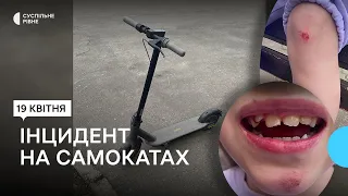 "Струс мозку та пошкоджені зуби": у Рівному чоловік на електросамокаті зіштовхнувся із дитиною