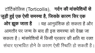 Torticollis Treatment In Hindi | Torticollis (Twisted Neck) के बारे में जाने