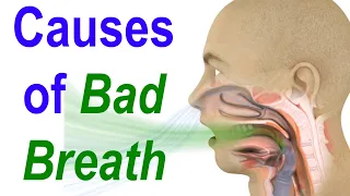 Sources of Bad Breath or Halitosis: Evaluate, Diagnose, and Treat