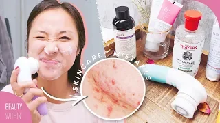 9 Skincare MISTAKES That Can Make ACNE & Large PORES Worse! (Ft. Wishtrend TV)