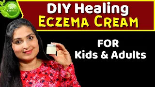 Natural Healing Cream for Eczema and Psoriasis | Itchy Skin Relief | Dry Skin Remedy #eczema